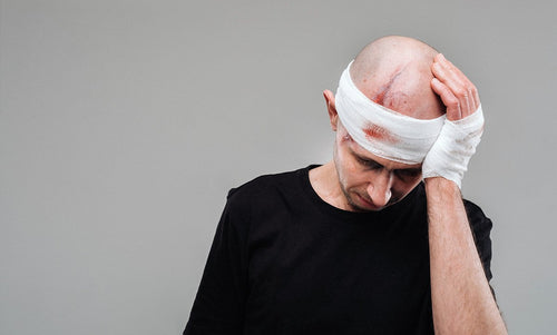 Stress Slow Down Wound Healing