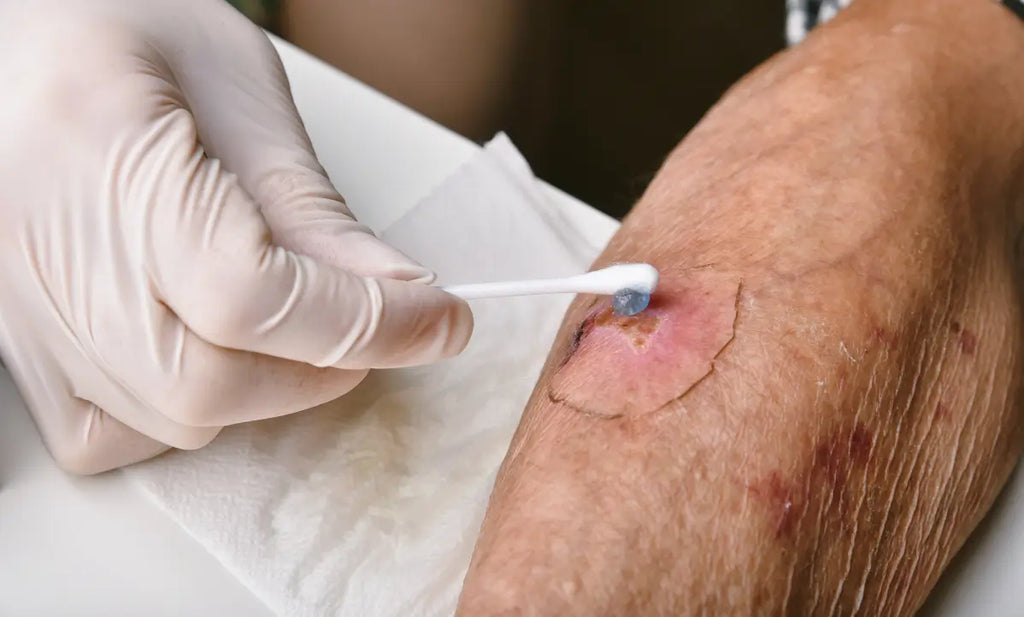 How Collagen Particles Support Tissue Repair During Wound Healing
