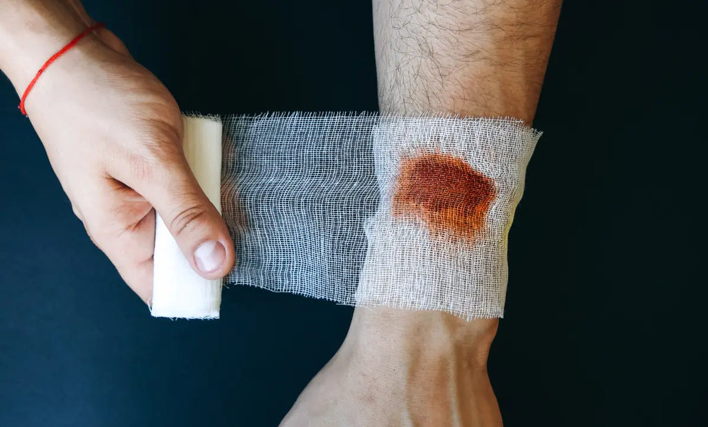 Can Chronic Wounds Heal Without Surgery?