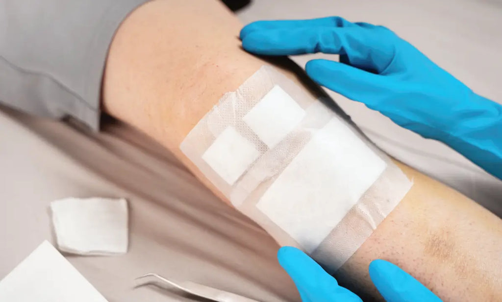 Which Wound Dressing Should You Use? A Complete Decision Guide by Wound Type
