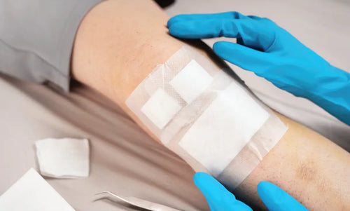 Which Wound Dressing Should You Use? A Complete Decision Guide by Wound Type