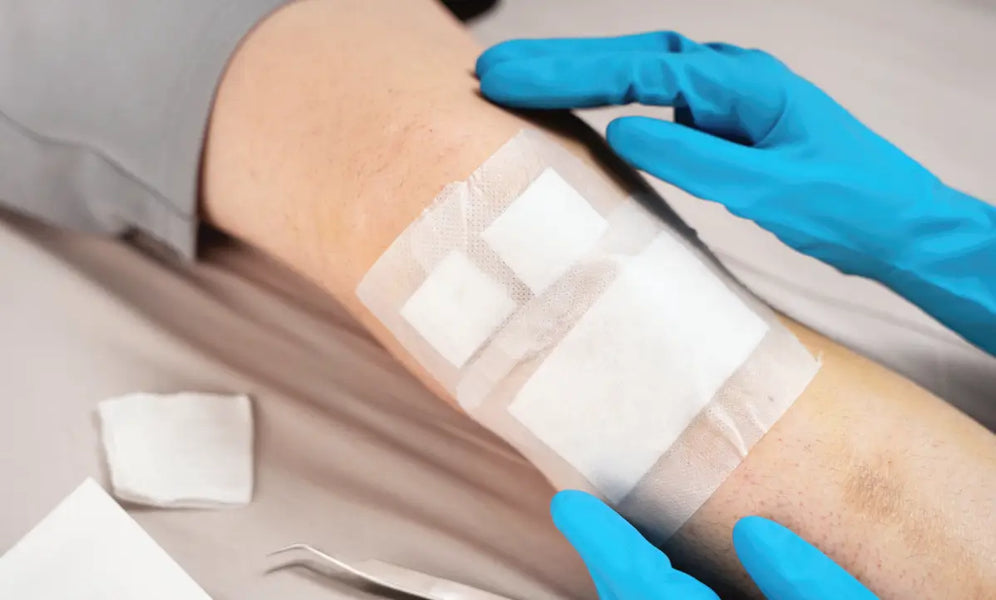 open wound dressing Care: Treatment and Complications Wound Cleaning and Dressing