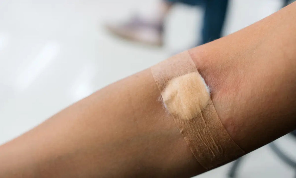 Why Collagen Is the Missing Link in Chronic Wound Treatment