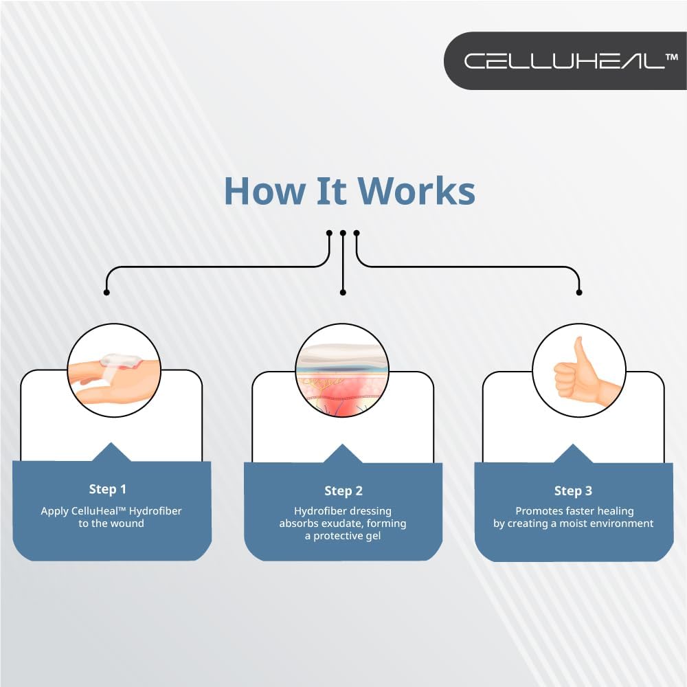 Hydrofiber dressing for burns