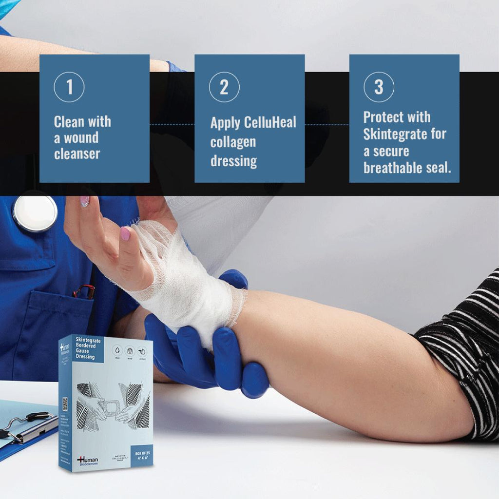 Skintegrate Bordered Gauze Dressing Advanced Absorption for Lightly Draining Wounds CelluHeal Skintegrate Bordered Gauze Dressing Advanced Absorption for Lightly Draining Wounds CelluHeal